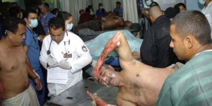 Foto Kebakaran Penjara Honduras Renggut Ratusan Nyawa Tahanan Terpanggang