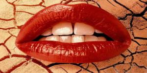 5 Tips Mengatasi Bibir Kering & Pecah-pecah