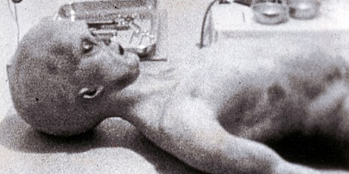 foto-autopsi-alien-tahun-1947-terbukti-asli-1898.jpg