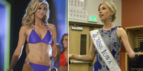 Nicole Kelly, Ratu Kecantikan Iowa 2014 Terlahir Dengan Satu Tangan