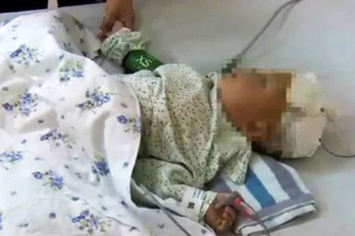 bayi 1 tahun tertancap sumpit menembus otak bayi 1 tahun tertancap sumpit menembus otak