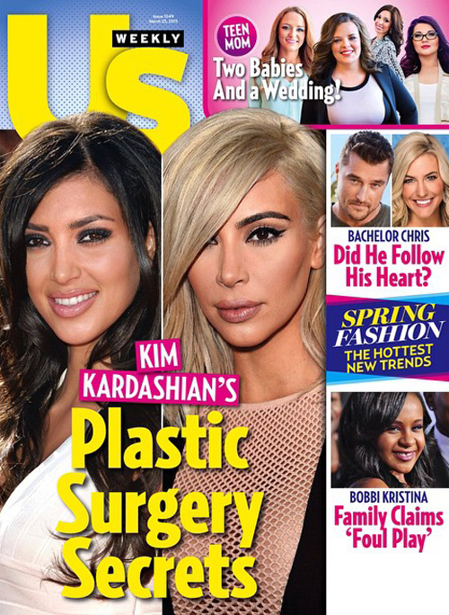 Kim Kardashian sebelum dan sesudah operasi plastik