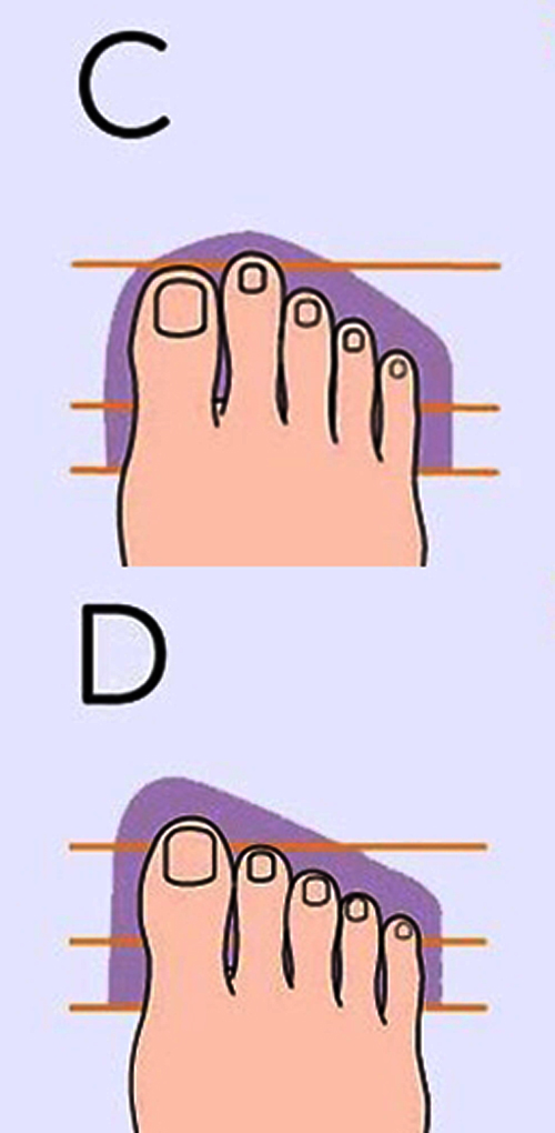 Gambar bentuk kaki tipe C dan D @Viralmega/Newsner.com