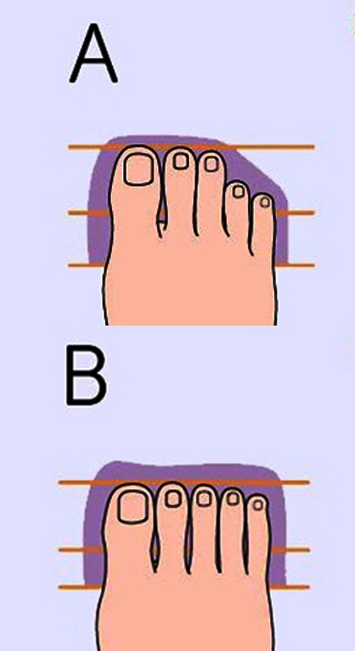 Gambar bentuk kaki tipe A dan B @Viralmega/Newsner.com