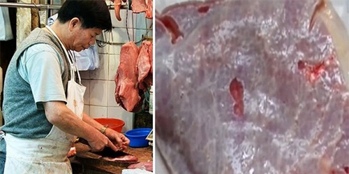 Hobi Makan Daging Mentah, Tubuh Pria China Keluarkan Cacing 6 Meter