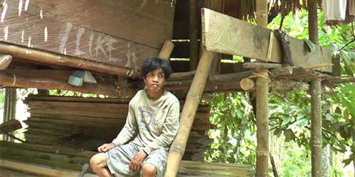 Tubuh Penuh Kutil, Basir Menyendiri di Hutan Sulawesi 20 Tahun