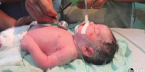 Bayi Palestina Lahir Selamat Setelah Ibunya Tewas dalam Serangan Israel