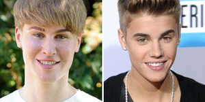Terobsesi Justin Bieber, Pria 33 Tahun Operasi Plastik Rp 1 Miliar