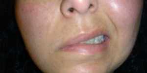 Pasien Salah Cabut Gigi di Australia Dapat Ganti Rugi Rp 8 Miliar