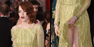 Celana Dalam Emma Stone Ngintip di Oscar 2015