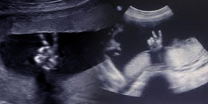 Difoto USG, Bayi Acungkan Jari Simbol 'Peace'