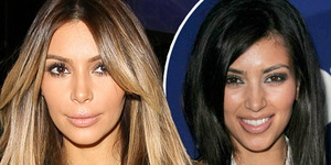 Wajah Cantik Kim Kardashian Hasil Operasi Plastik?