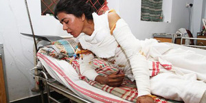 Ogah Dinikahi, Gadis Pakistan Dibakar Mantan Pacar