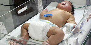 Ajaib, Bayi 'Raksasa' Seberat 6,7 Kg Lahir dengan Normal