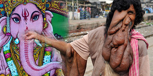 Wajah Mirip Gajah, Pengemis India Dianggap Titisan Dewa