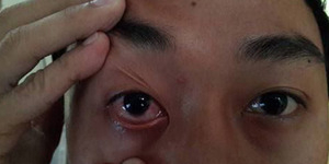 Aksi Begal Marak di Jogja, Pelaku Siramkan Air Aki