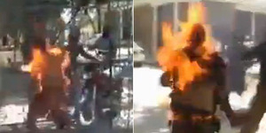 Tubuh Pria Ini Terbakar Gara-gara Baterai Ponsel Meledak
